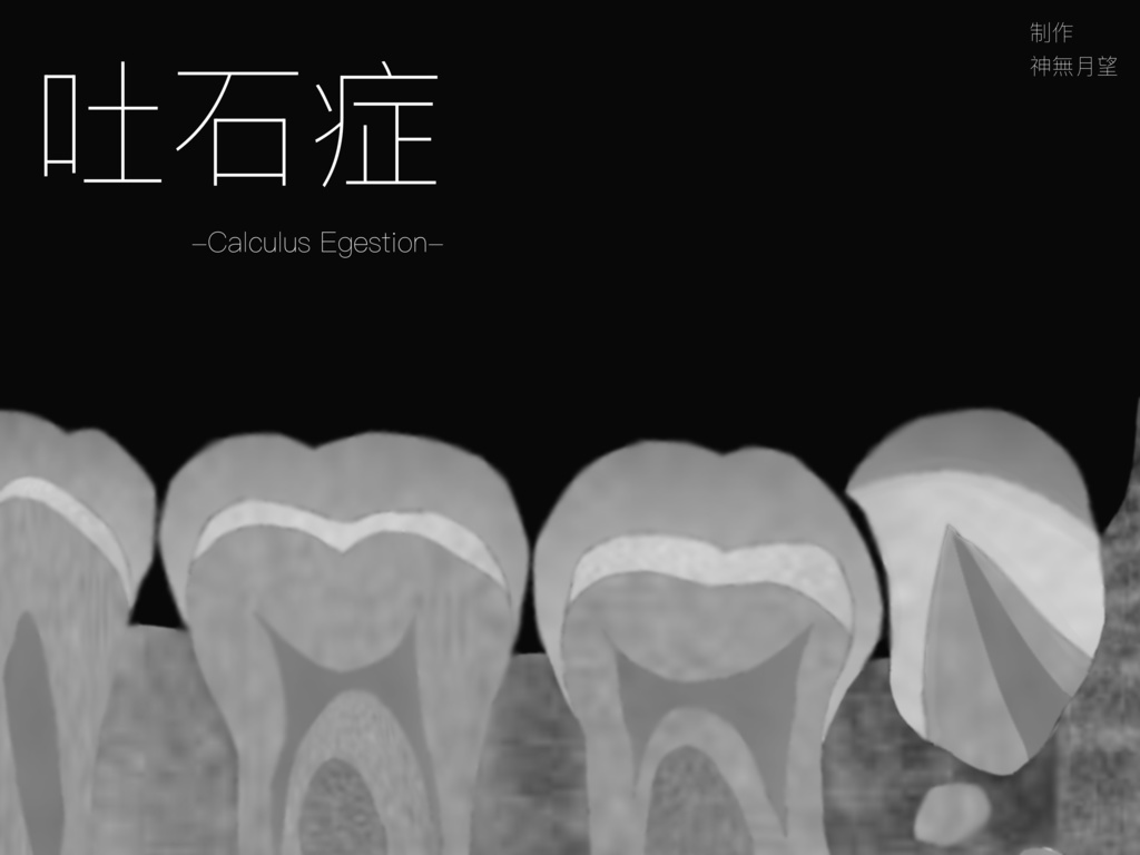 【CoCシナリオ】 吐石症 -Calculus Egestion