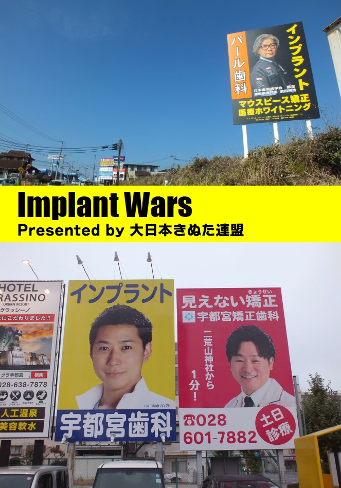 【匿名配送】Implant Wars~名古屋・札幌・宇都宮・熊本から~