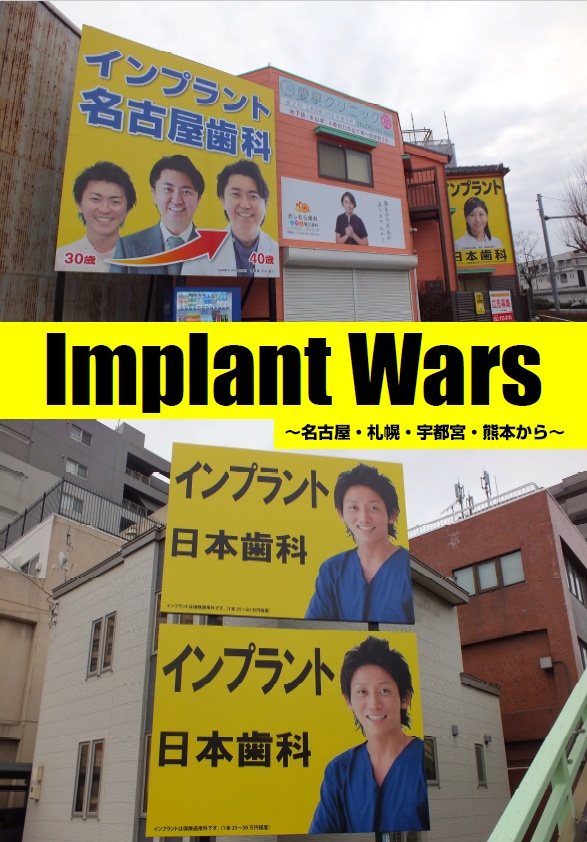 【匿名配送】Implant Wars～名古屋・札幌・宇都宮・熊本から～
