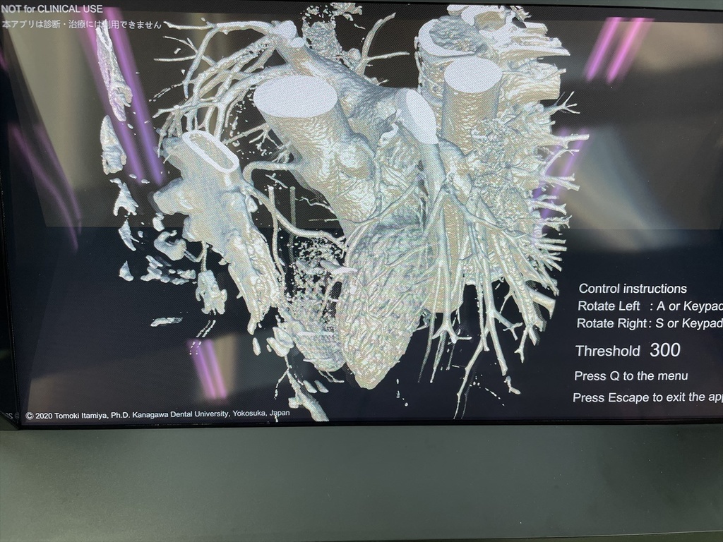 空間再現ディスプレイ用DICOM立体視ビューワーDSRView(デモ版)