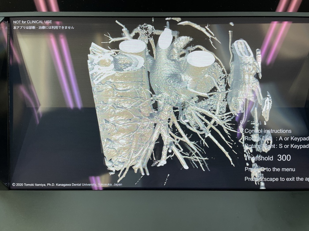 空間再現ディスプレイ用DICOM立体視ビューワーDSRView(デモ版)