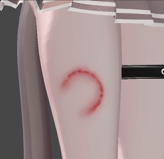 bite mark