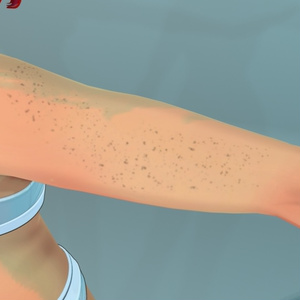 Body freckles for Lasyusha 缩略图 3