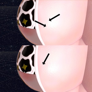 Areola Fix