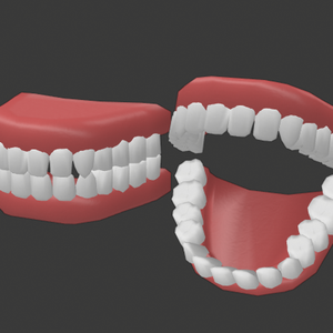 denture