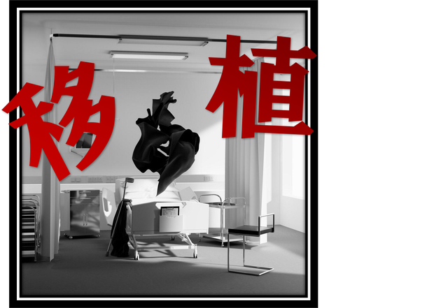 移植