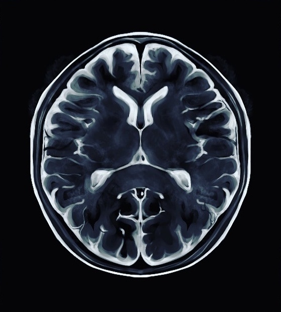 脳MRI 2 .3セット - 健康・医学