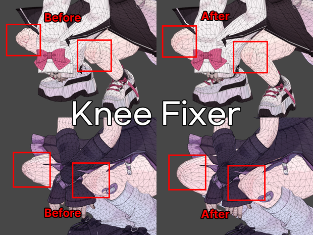 【MA】Knee Fixer