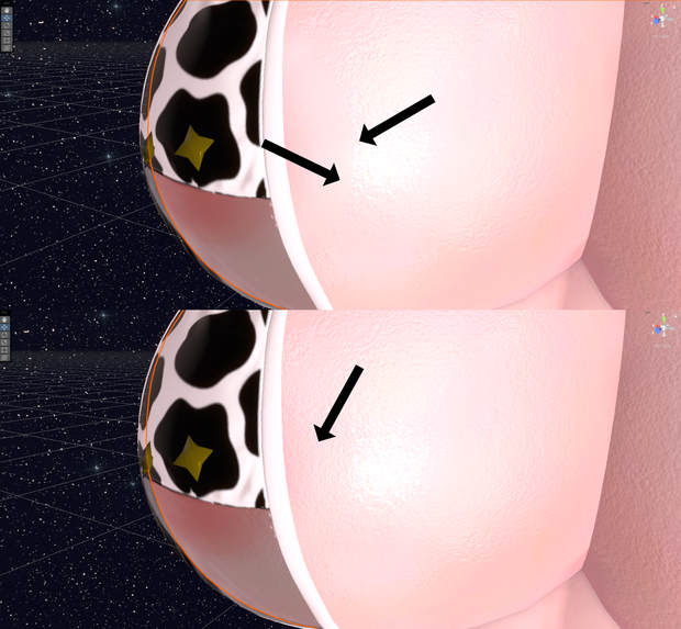 Areola Fix