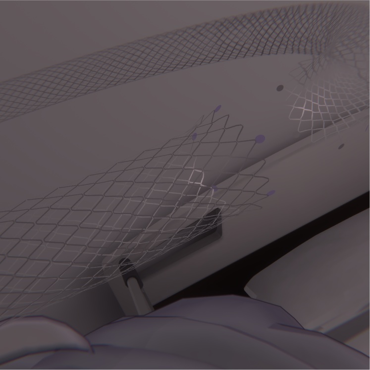 【無料】ステントヘイロー