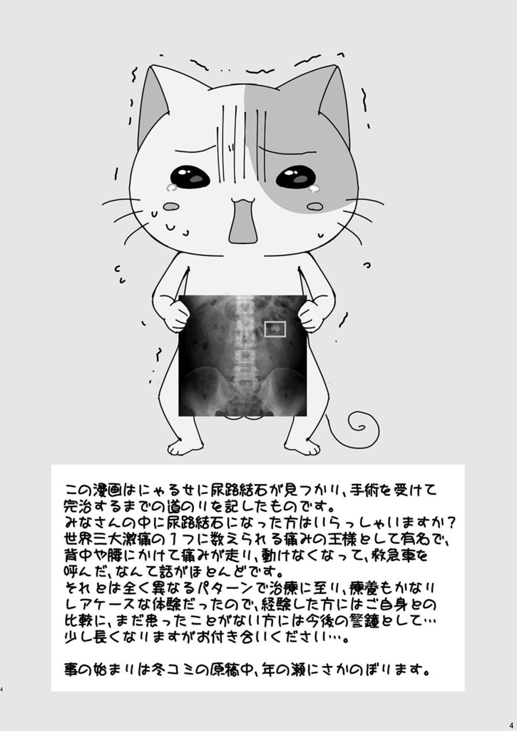 尿路結石で手術したらちんこ破壊された話