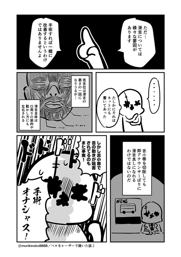 【電子書籍/紙の本】ベロをレーザーで焼いた話2