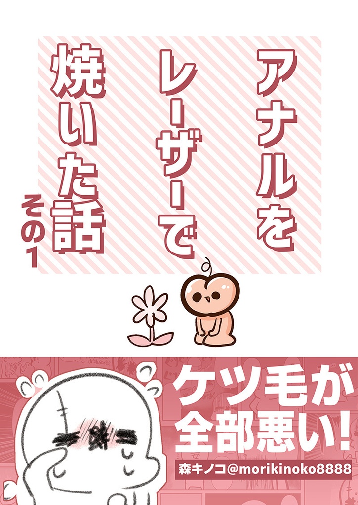 【電子書籍/紙の本】アナルをレーザーで焼いた話その1