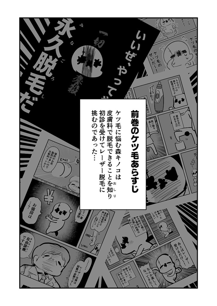 アナルをレーザーで焼いた話その2