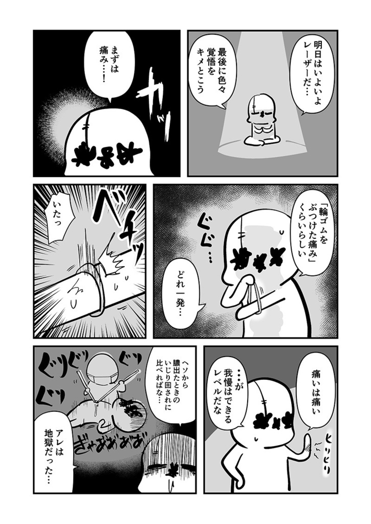 アナルをレーザーで焼いた話その2