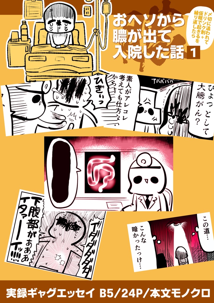 【電子書籍/紙の本】新版:ヘソから膿が出て入院した話‐序章‐