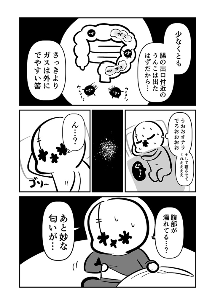 〆切に追われて栄養剤+仮眠を繰り返していたらおヘソから膿が出て入院した話2