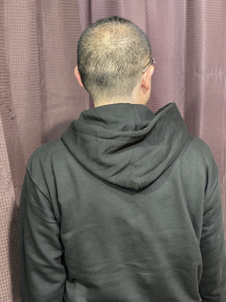 なつばやしくんパーカー01 ブラック