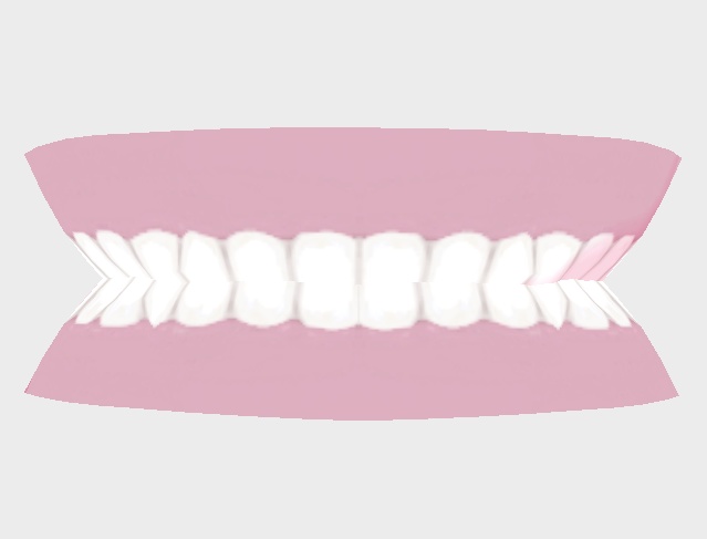 入れ歯_teeth