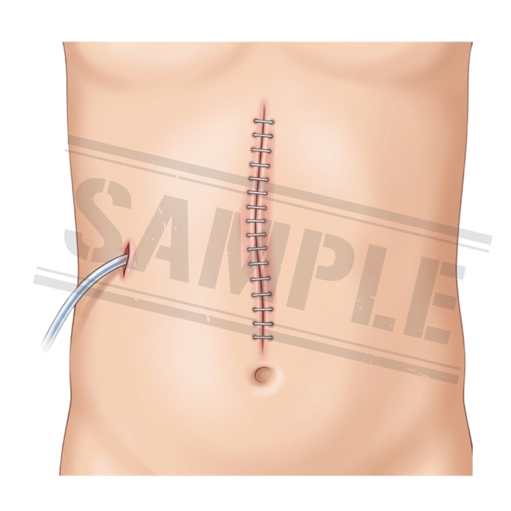 【医療素材】外科系のシンプルで使いやすい医療クリップアートセット