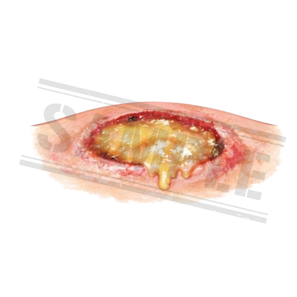 【医療素材】外科系のシンプルで使いやすい医療クリップアートセット