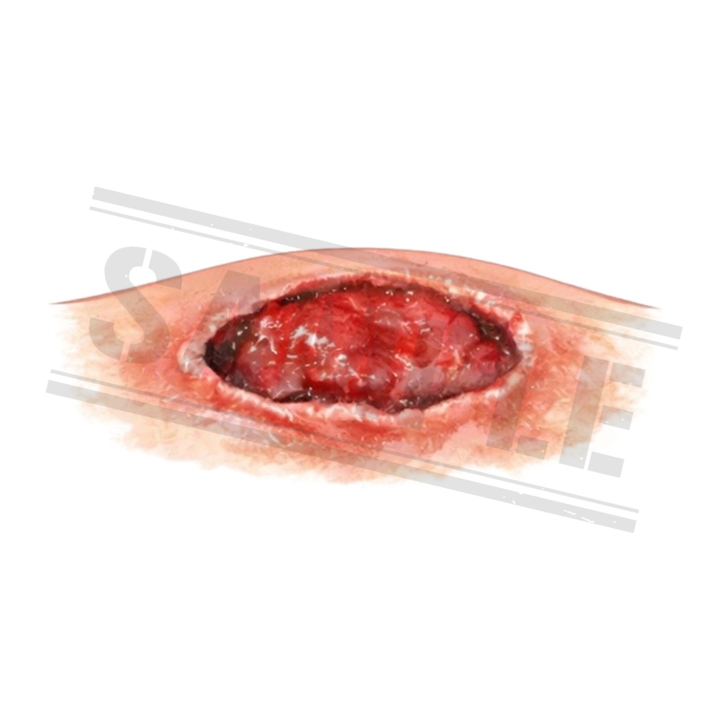 【医療素材】外科系のシンプルで使いやすい医療クリップアートセット