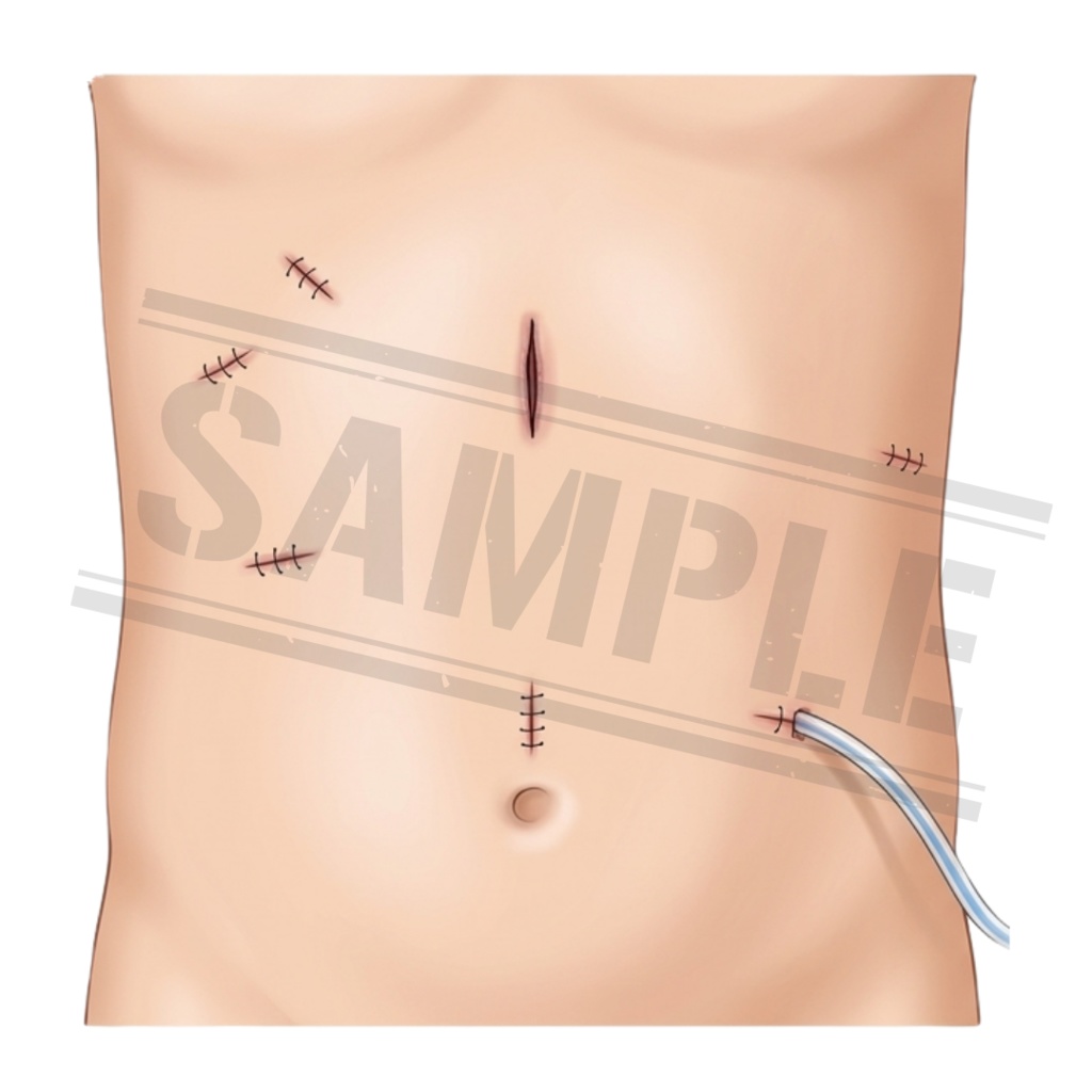 【医療素材】外科系のシンプルで使いやすい医療クリップアートセット