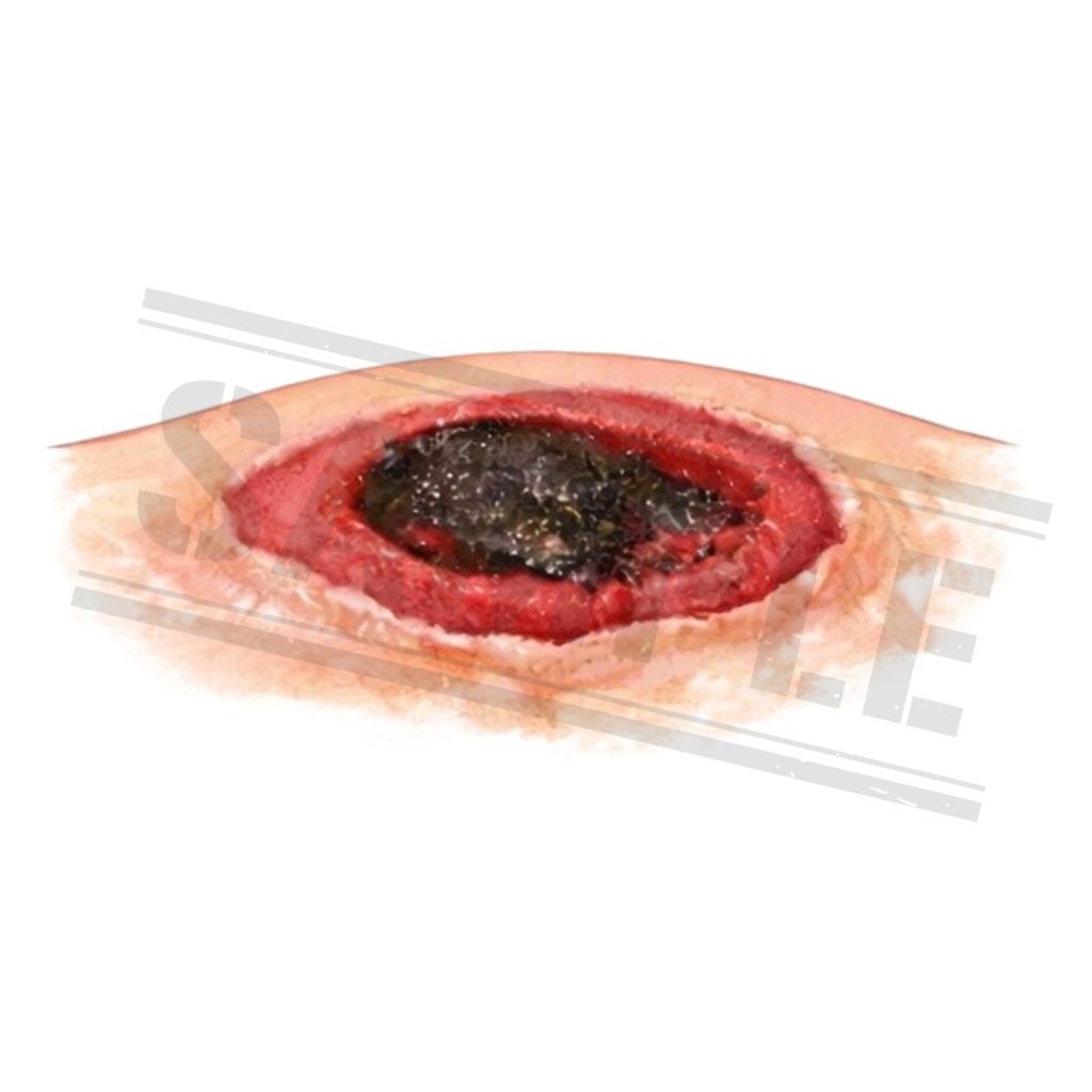 【医療素材】外科系のシンプルで使いやすい医療クリップアートセット