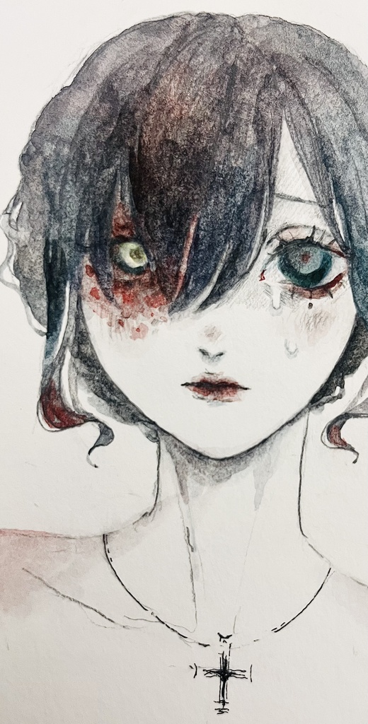 火傷の少女