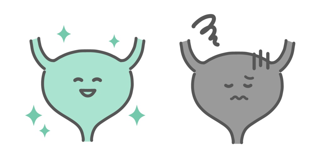 健康な膀胱と不調な膀胱の比較イラスト（キャラクター）