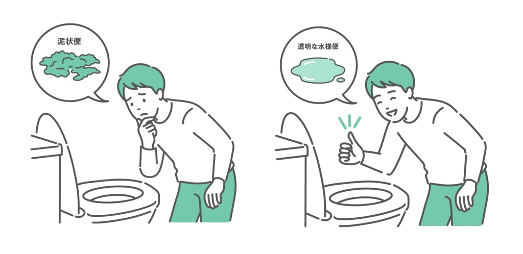 大腸カメラ前処置の便の状態比較イラスト(泥状便NG・透明な水様便OK)