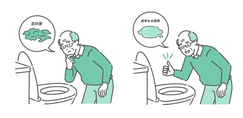 大腸カメラ前処置の便の状態比較イラスト(高齢男性・泥状便NG・透明な水様便OK)