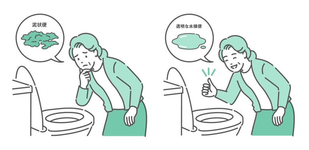 大腸カメラ前処置の便の状態比較イラスト(高齢女性・泥状便NG・透明な水様便OK)