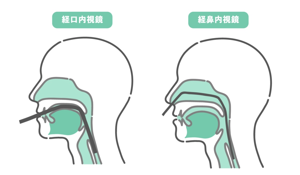 胃カメラの挿入ルート比較イラスト（経口と経鼻の断面図・メカニズム）