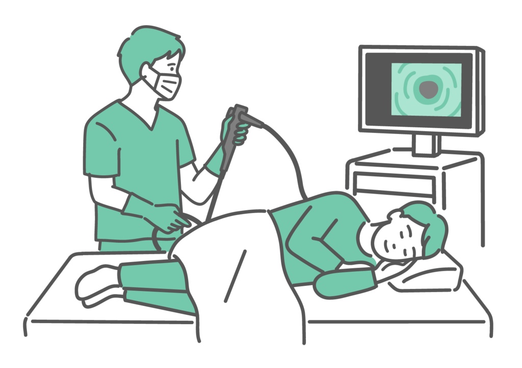 鎮静剤で眠りながら大腸カメラ検査を受ける男性のイラスト