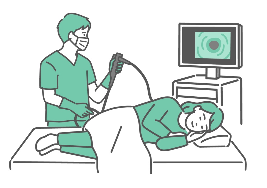 鎮静剤で眠りながら大腸カメラ検査を受ける女性のイラスト