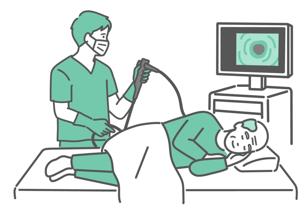 鎮静剤で眠りながら大腸カメラ検査を受ける高齢男性のイラスト