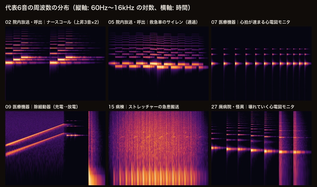 病院・廃病院 効果音 29音|ナースコール・心電図モニタ・除細動器・ストレッチャー・救急車・院内放送+深夜のICU/廃病棟ループ|クトゥルフ・現代ホラーTRPG・ココフォリア対応・WAV+MP3・商用可