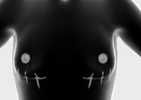 trans surgery scars for vroid (READ DESC)