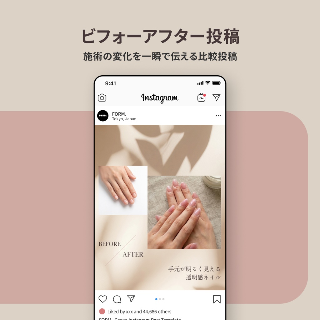 ネイルサロン向け|Instagram投稿テンプレート|5枚セット・Canva対応