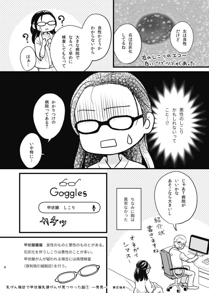 乳がん検診で甲状腺乳頭がんが見つかった話1ー発見ー