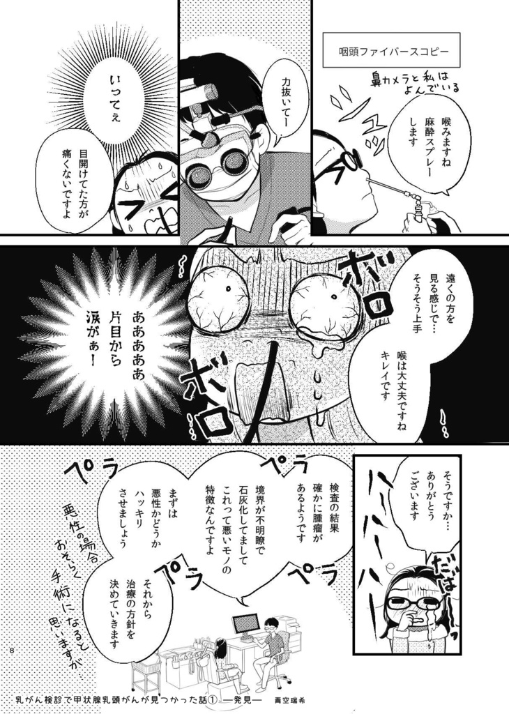 乳がん検診で甲状腺乳頭がんが見つかった話1ー発見ー