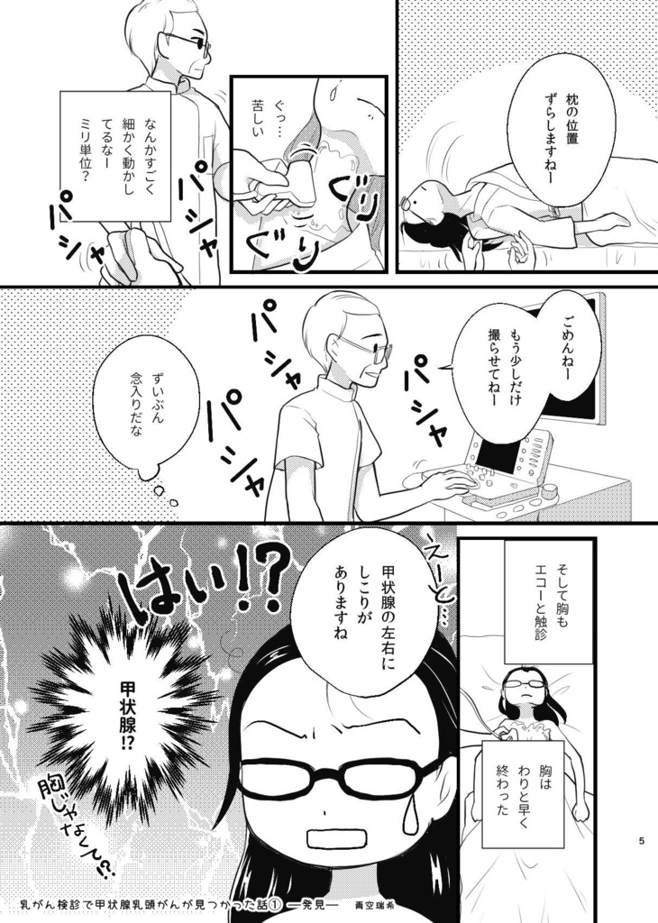 乳がん検診で甲状腺乳頭がんが見つかった話1ー発見ー