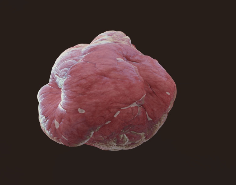 がん、皮膚細胞、皮脂、心臓 — 「Meat & Heart」医療用ゲームアセットパック