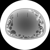 黒スラ洞